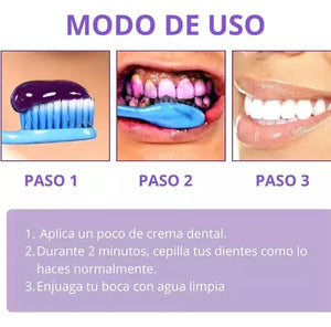 Blanqueador Dental Smilekit V34 - Dientes blancos en 1 minuto