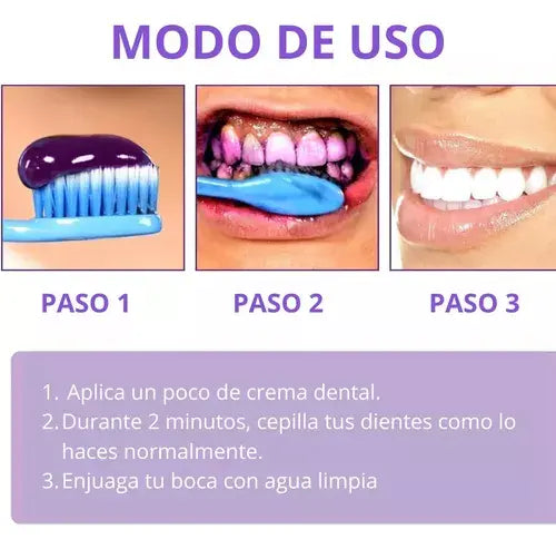 Blanqueador Dental Smilekit V34 - Dientes blancos en 1 minuto