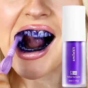 Blanqueador Dental Smilekit V34 - Dientes blancos en 1 minuto